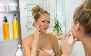 An Inside Look at Acne